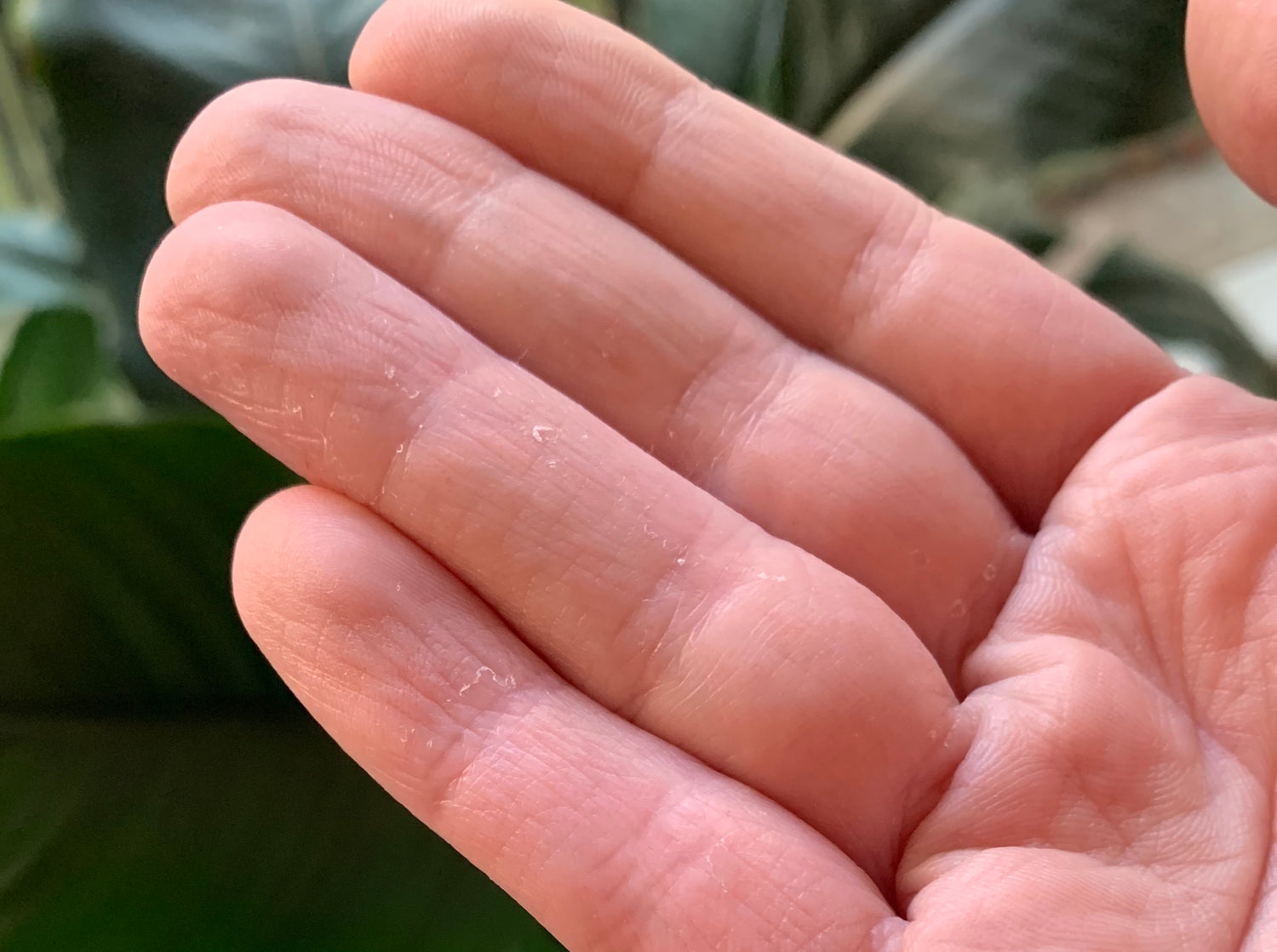 The reason why your hands are dry from washing and sanitising!