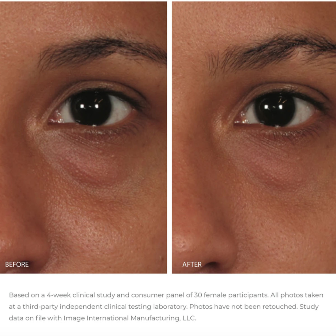 Ormedic Balancing Eye Lift Gel