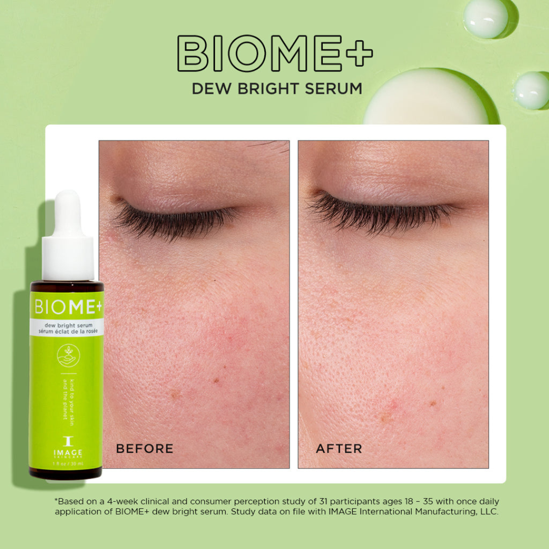 Image Biome+ Dew Bright Serum
